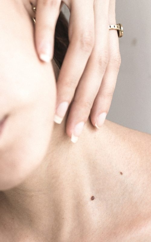 melanom promjena boje madeža